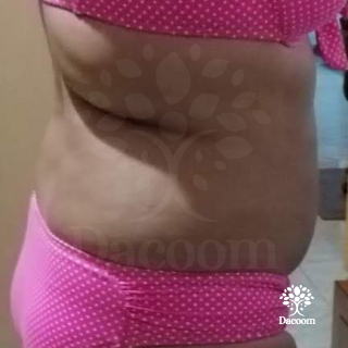 masajes reductivos maderoterapia cancun