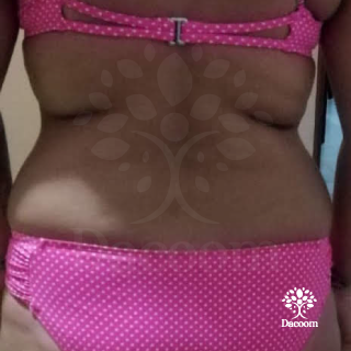 masajes reductivos maderoterapia cancun