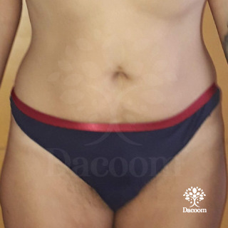 masajes reductivos maderoterapia cancun